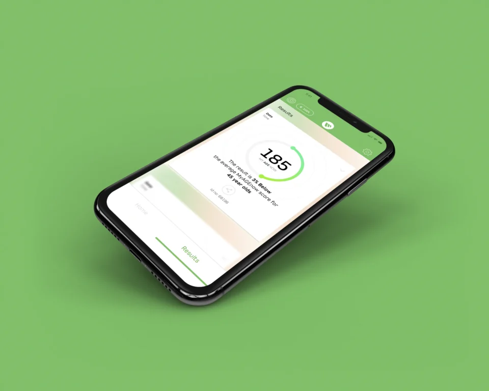 Case - Diagnoptics - Mockup Mobile